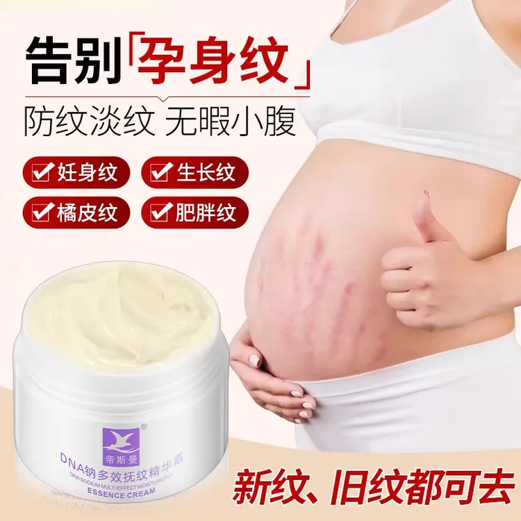 肥胖纹生长纹大腿学生腰腹上肥胖纹男女通用膏产后纹肚皮纹霜油乳