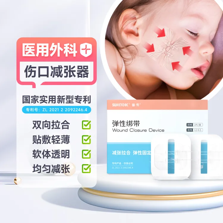 SWEETCHIC蜜秀医用减张器减张贴免缝针缝合胶布拉链式拉合弹性绑带