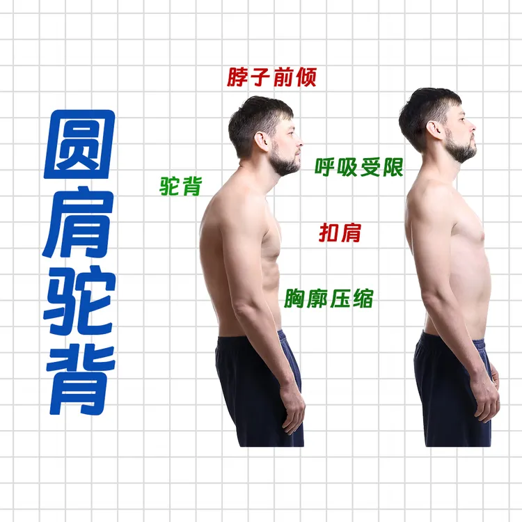 圆肩驼背视频课程