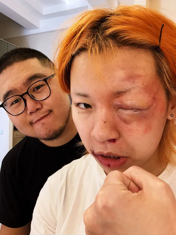 肿眼假皮 老鼠鼻子假皮 铂金硅胶可溶边 超自然