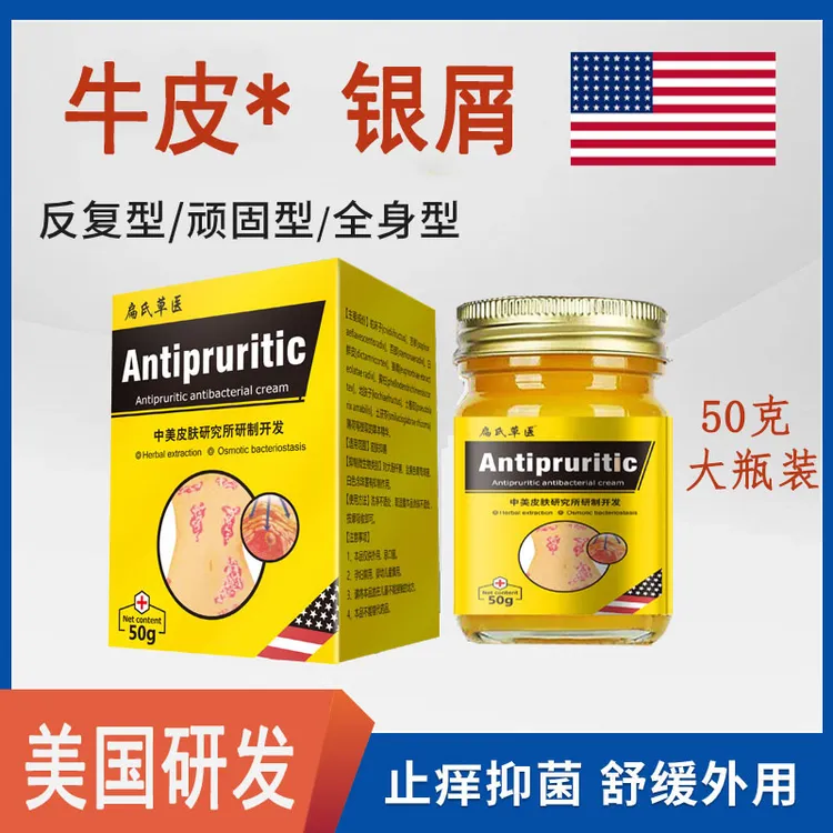 美国研发牛皮止痒膏皮肤痒红点抓挠干痒草本萃取外用涂抹抑菌乳膏