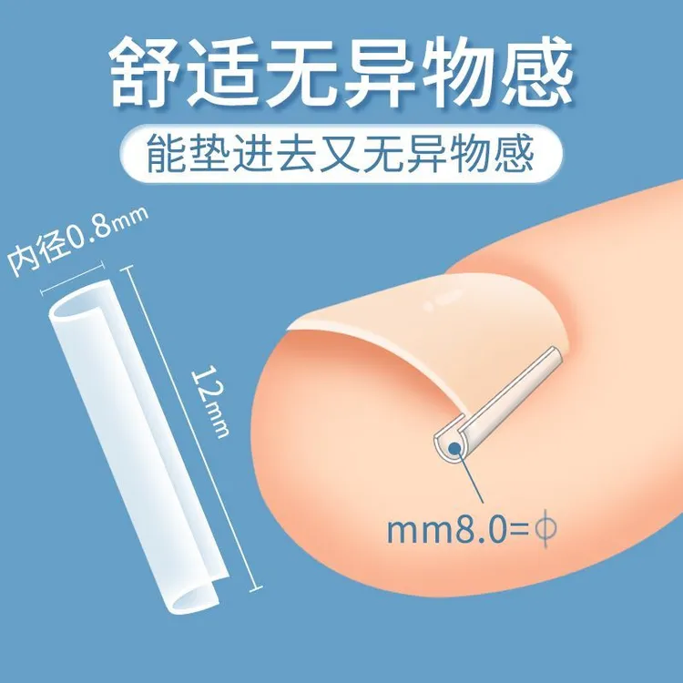 甲沟矫正神器嵌甲专用正甲贴片修脚刀趾甲扎肉指甲刀全套垫片炎
