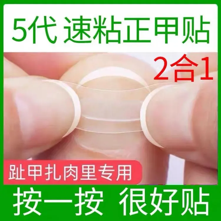 甲沟嵌甲矫正器炎正甲贴正甲垫贴片脚趾指甲往肉里长专用指甲刀剪