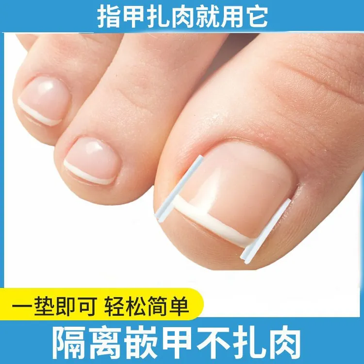 甲沟矫正神器嵌甲正甲贴趾甲矫正器趾甲不再扎肉甲沟炎矫正神器