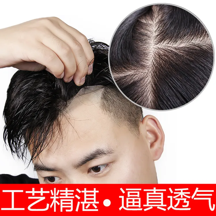 （递针款）男士补发片假发块卡子胶片两用栗子头飞机头自然款毛寸