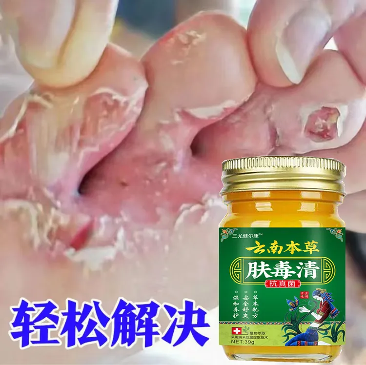 止痒膏去脚出汗脱皮起水炮干裂脚趾缝痒抑菌止痒神器