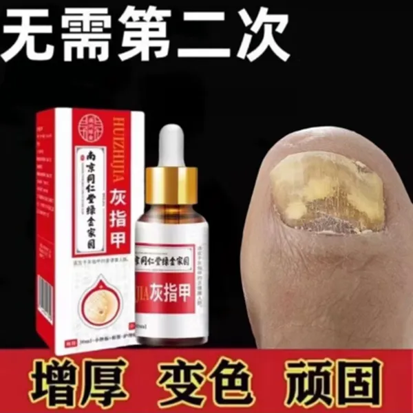 南京同仁堂凤仙花抑菌液灰趾指甲亮甲草本去坏软甲修护脚指甲专用