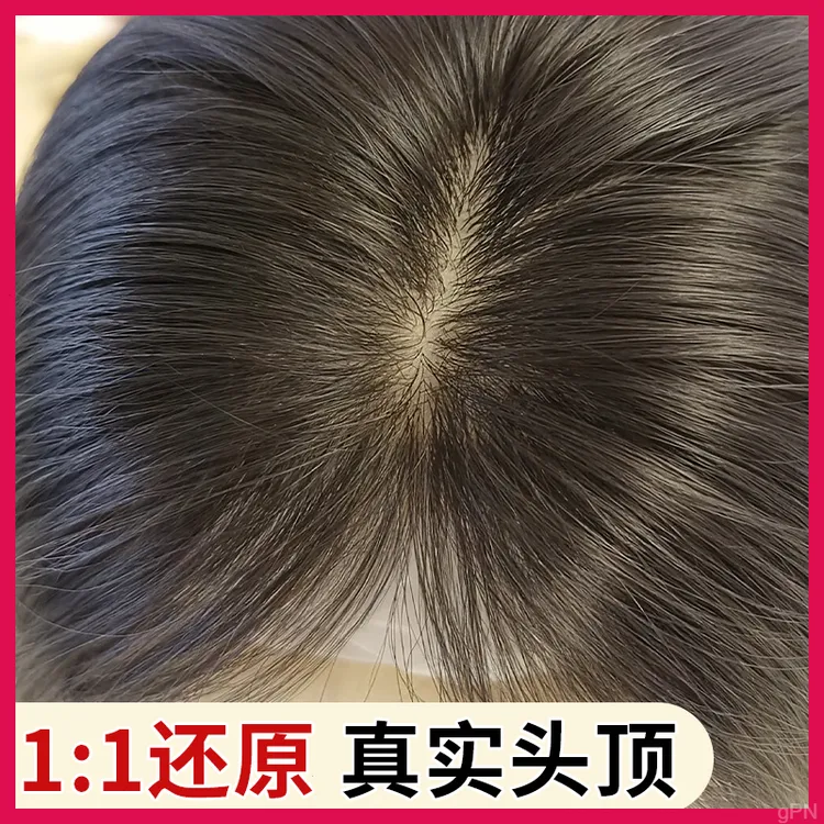 双递针假发片真发女头顶遮白发增发量高颅顶神器无痕补发片仿肤网