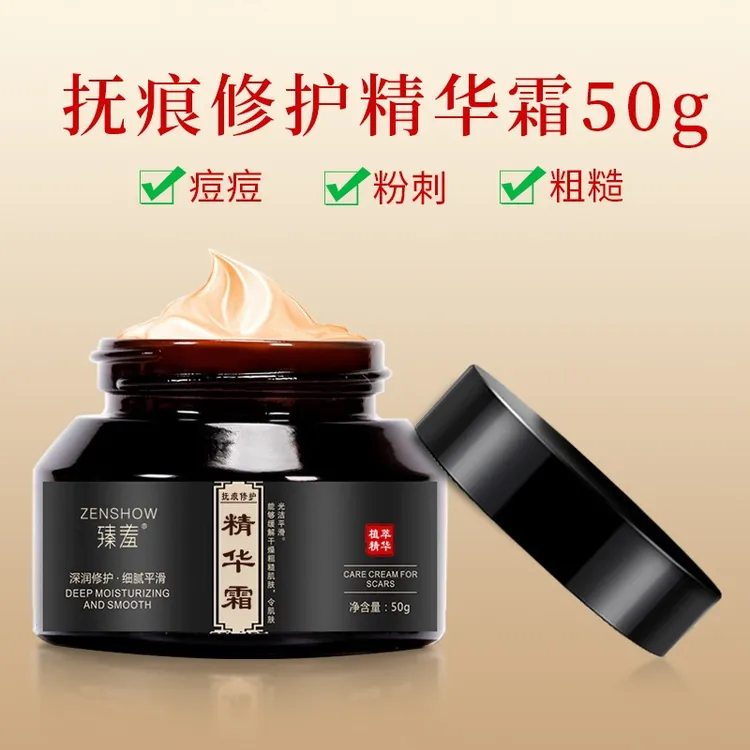 正品补水肌肤柔滑修护霜抚痕修护产后修护抚平肌肤舒缓膏祛痘印