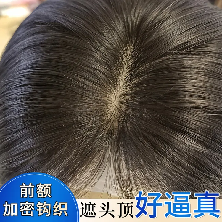君知否加密钩织假刘海假发片头顶全真发高颅顶一片式自然补发女