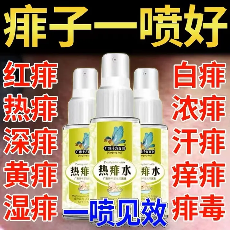 去热痱子水祛痱止痒膏喷雾大人去痱热痱水儿童宝宝成人爽身粉神器