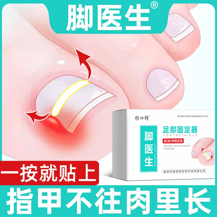 JIAOYISHENG/脚医生足部固定器甲沟炎嵌甲矫正器正甲贴脚趾甲贴片指甲扎肉里专用