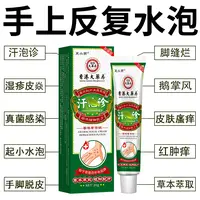 【香港大药房】手上起小水泡汗状水泡痒手指脱皮专用手足脱皮外用膏