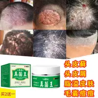 头藓毛囊膏头部头皮屑藓抗真菌抑菌膏头皮痒止痒结痂草本外用乳膏