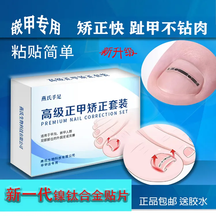嵌甲正甲贴 矫正指甲不往肉里钻 好帖不掉 记忆回弹不变形