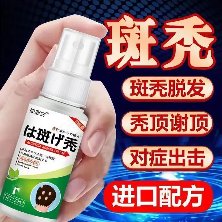 斑秃鬼剃头严重掉发秃顶突发性斑秃非瘢痕性突发成片脱发