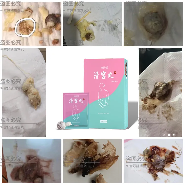 清宫丸女性私密保养护宫避味排脏排污紧致补水滋正品中草草
