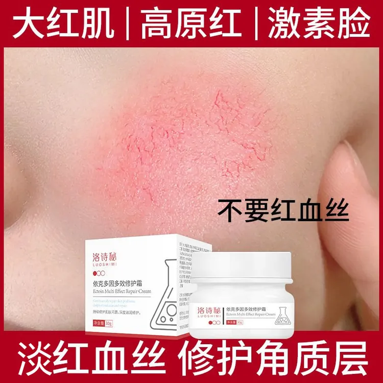 洛诗秘依克多因舒缓面修护红血丝大红脸泛红敏感肌增厚角质层保湿