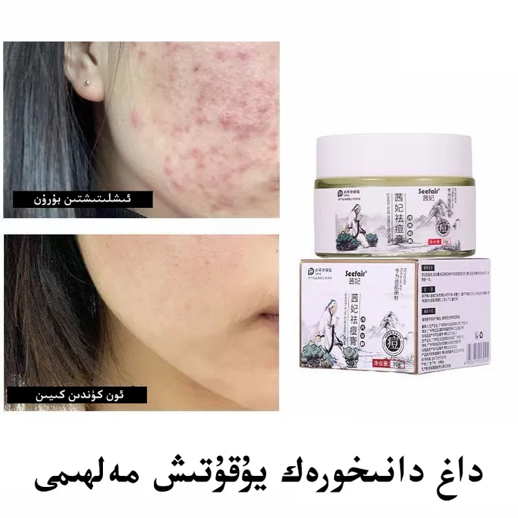 新疆包邮茜妃祛痘膏danihorak和田30克装dag may男女通用款学生款