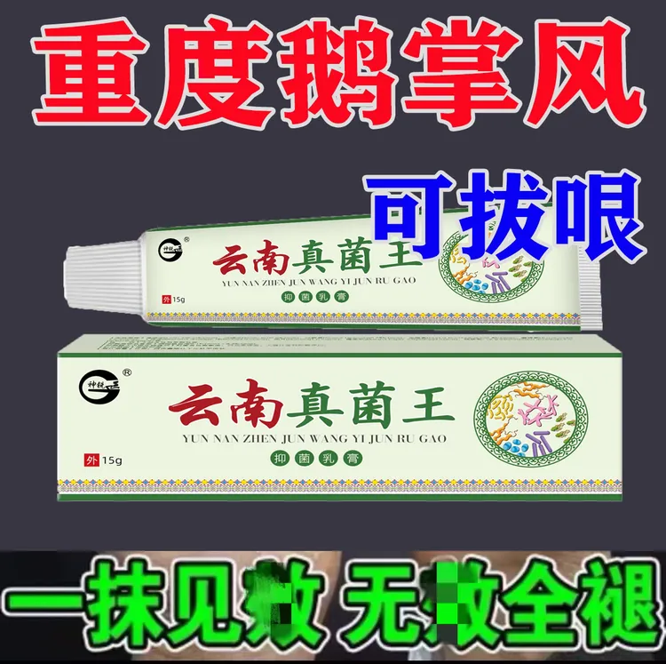 鹅掌风手足裂口脱皮发痒手上干裂脱皮止痒草本抑菌软膏