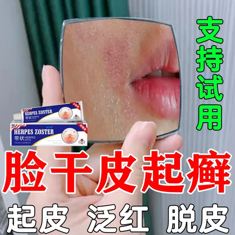 脸干燥起皮脸上皮肤干燥起皮鼻子两侧嘴角皮泛红干痒草本修护DZ膏