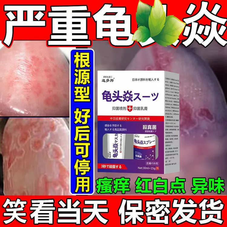 男女私处白点红点污垢脱皮异味瘙痒生殖菜花头珍珠红斑氺泡私处痒