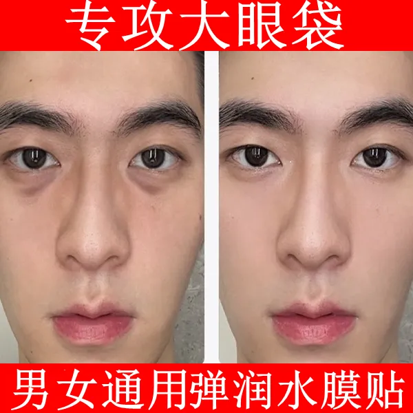 眼膜贴改善眼袋神器男士女专用祛淡化黑眼圈眼膜紧致抗皱淡细纹
