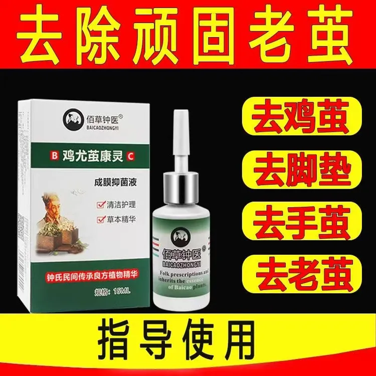 佰草钟医去老茧脚垫死皮胼胝神器鸡尤茧康灵15ml