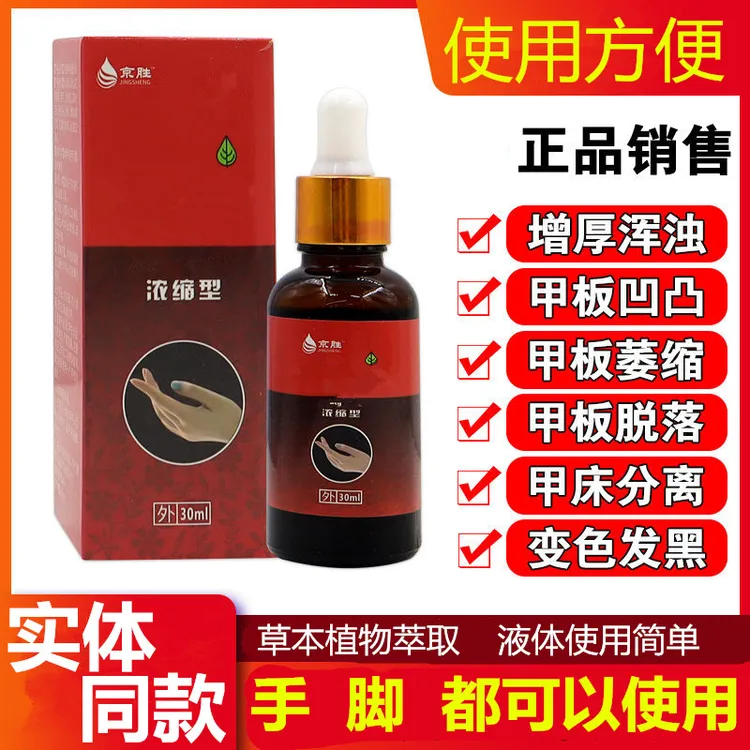 凹凸变灰色指分离甲增厚空甲粉末碎屑起翘不平手指甲脚指甲凤仙花