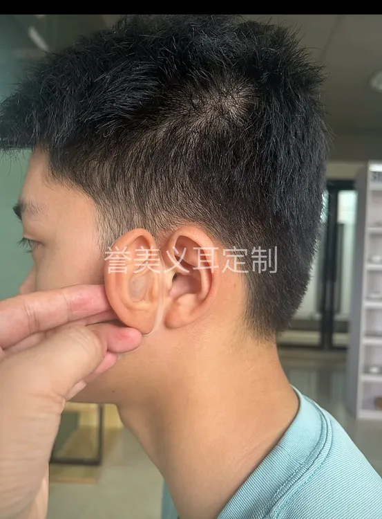 义耳定做残疾人可戴小耳畸形耳朵增大仿真