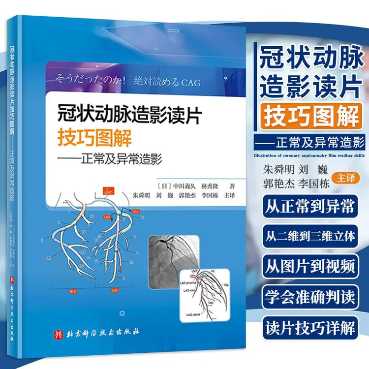 冠状动脉造影读片技巧图解 正常及异常造影 教你从冠脉造影小白 