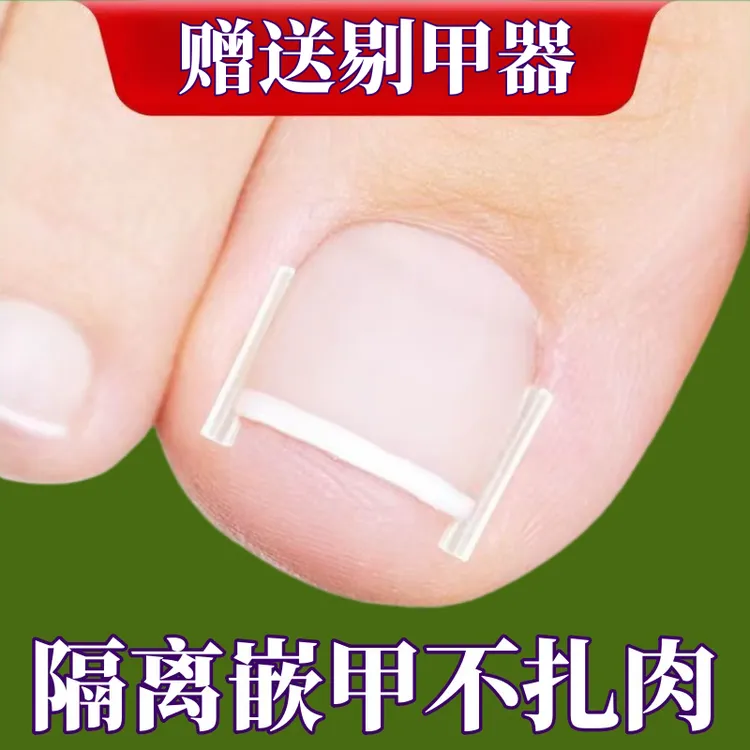 甲沟炎神器指甲矫正器大脚趾甲往肉里长专用修纠正隔离正甲贴垫片