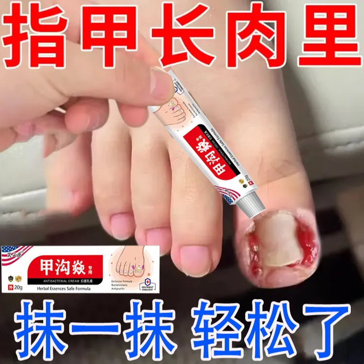 【闹闹推荐】正品草本抑菌膏手脚指甲痛疼修复专用抑菌外用涂抹软膏