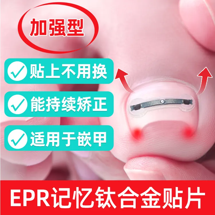 脚医生足部固定器指（趾）甲固定型钛合金硅胶贴片
