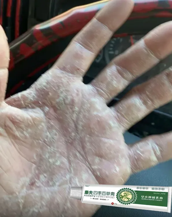 手足开裂干裂脱皮润肤护肤膏手足干裂皲裂起皮去皮止痒防裂专用膏