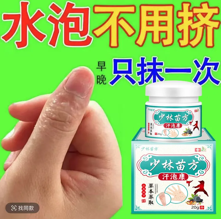 汗泡诊克星手上起小水泡止痒膏脱皮抑菌手指缝痒干裂专用草本乳膏