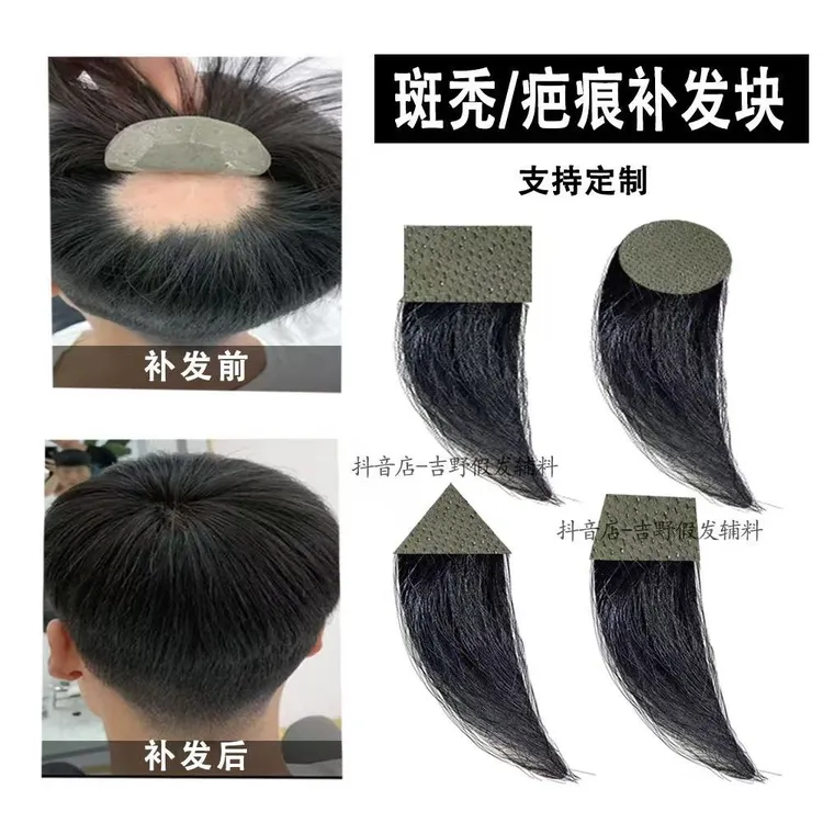 疤痕补发斑秃补发块补发小面积补发透气假发片胶贴