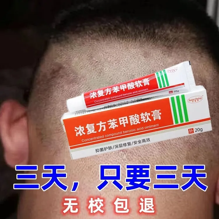 【无校可退】头皮头痒头上疙瘩头上长痘痘起干皮头上毛囊严深层抑菌