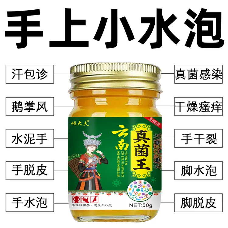 真菌王手脚起小水萢止痒膏脚趾缝烂痒脱皮抑菌开裂克星痒专用软膏
