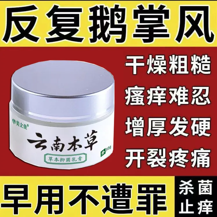 手足裂口脱皮鹅掌风发痒手上干裂脱皮干痒止痒草本正品抑菌软膏