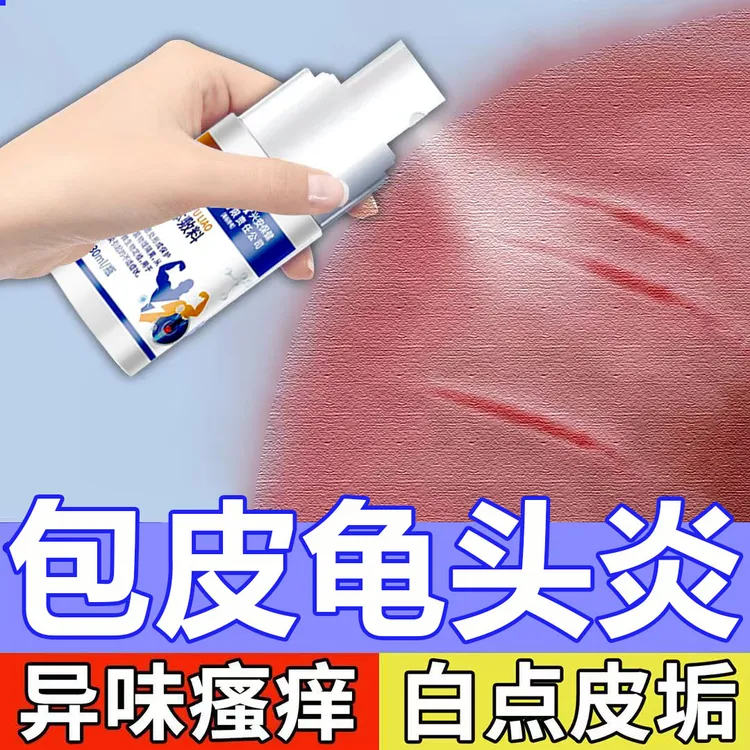 内廷上用北京同仁堂药业男士龟头包皮炎裂 开口子 包皮垢辅助治疗喷剂男性包皮龟头 炎专用裂疼痛医用液体敷料