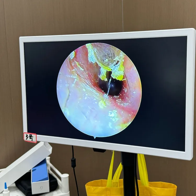 杨波采耳可可检测仪专业高清像素内窥镜冷光源可视22寸一体可视仪