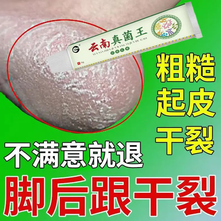 云南真菌王脚起皮脚脱皮修复膏脚后跟开裂皲裂防裂止痒膏