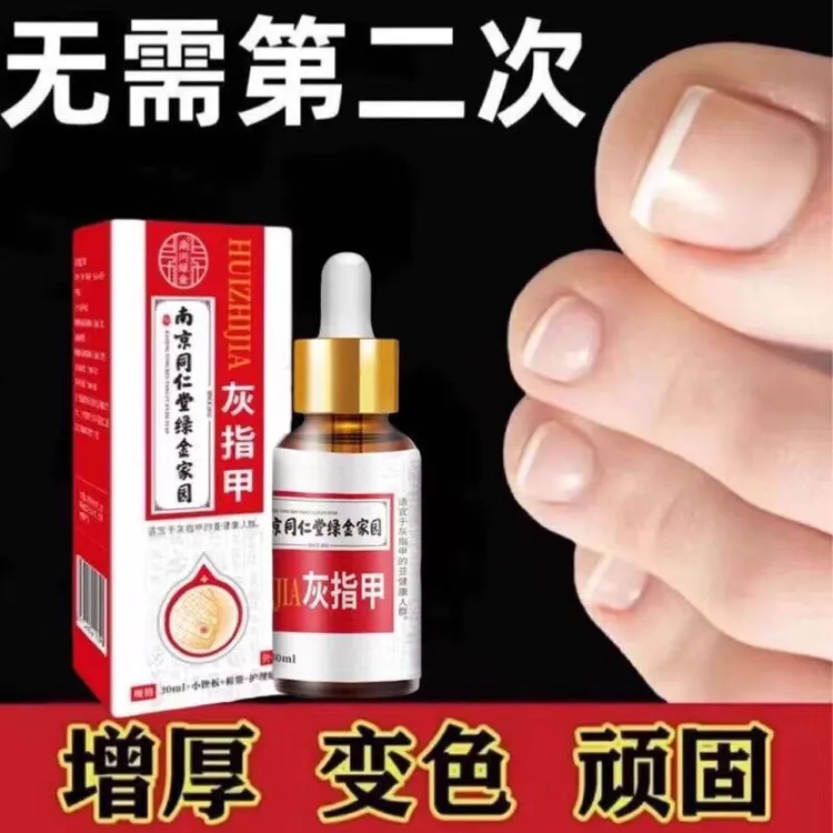 草本灰趾指甲亮甲凤仙花抑菌液去坏软甲修护脚指甲专用