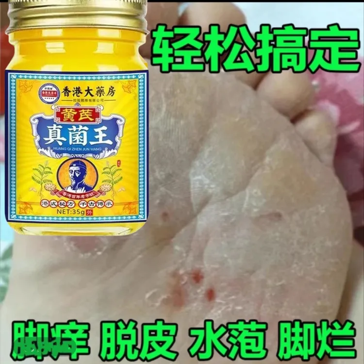 正品真菌王脚臭脚痒脱皮起水萢脚后跟干裂趾缝痒膝肘贴草本抑菌膏