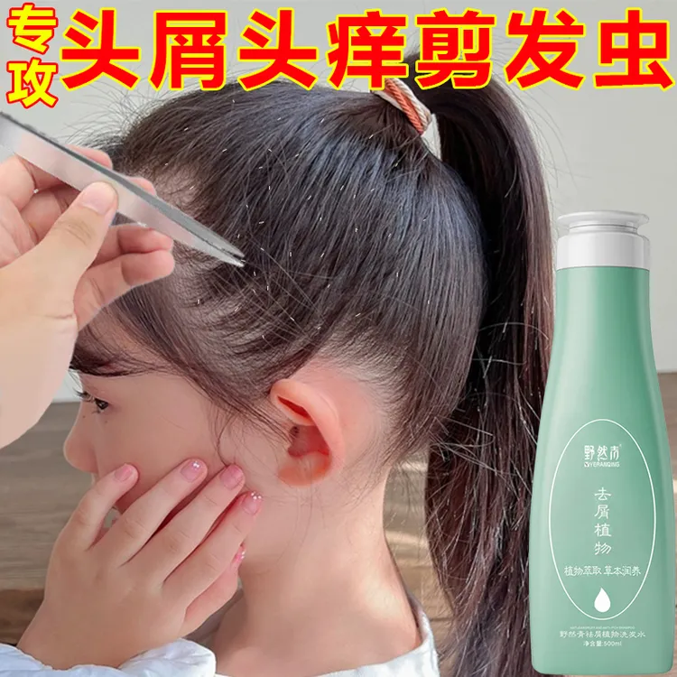 野然青洗发水控油蓬松去屑断痒洗头膏露男女孕妇除螨清爽柔顺留香