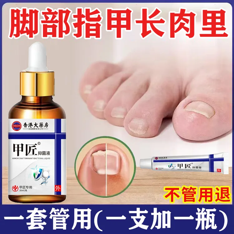 【甲匠严选】甲厚*甲黄*甲空*甲板脱落*灰甲抑菌膏+抑菌液