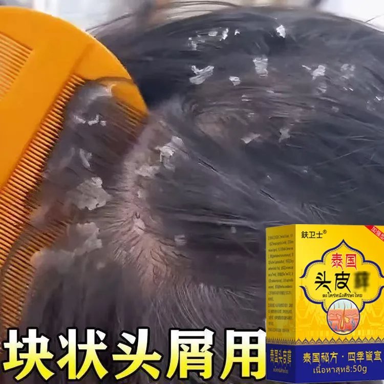 泰国真菌头廯抑菌头皮瘙痒结痂头皮屑多真菌感染头痒去头皮屑神器
