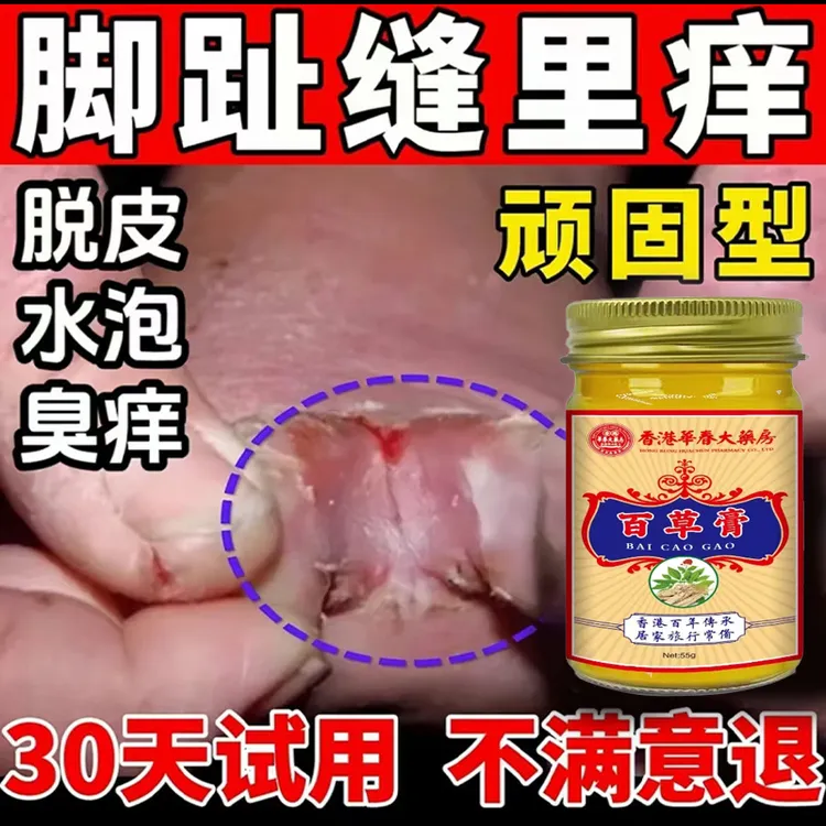 脚痒出汗脚脱皮起水炮干裂脚趾缝痒抑菌止痒神器足部护理止痒膏