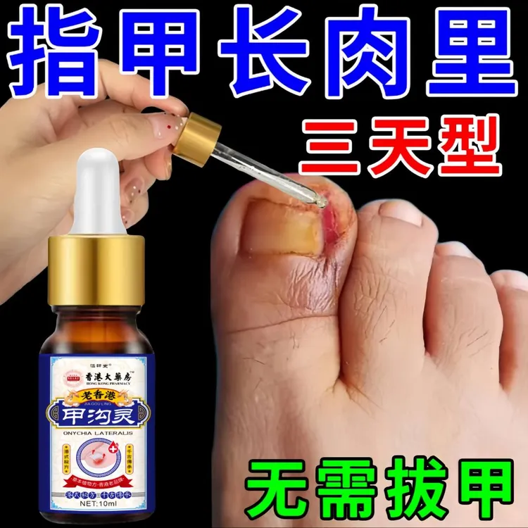 指甲长肉里甲沟肿大有脓包软甲脱甲脚指甲化脓脚趾头专用甲沟液